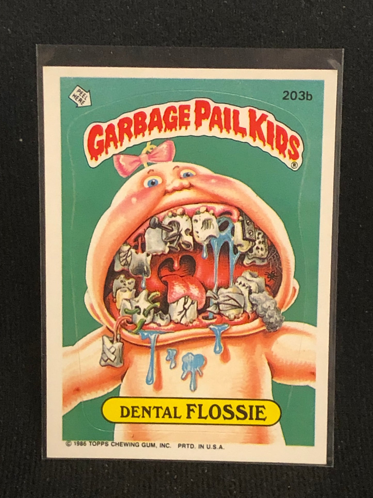 Garbage Pail Kids Original Series 5 (os5) 203b Dental Flossie