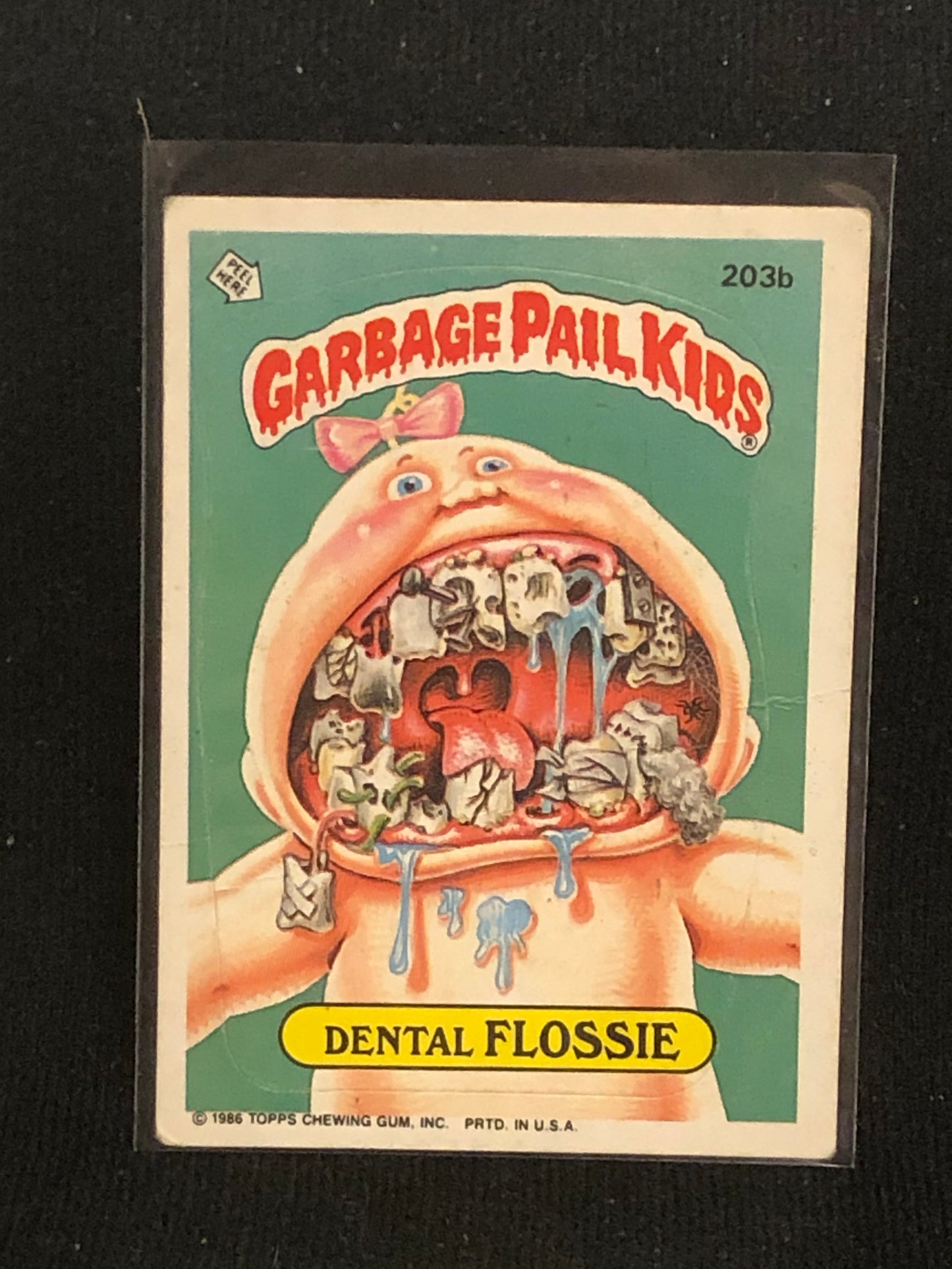 Garbage Pail Kids Original Series 5 (os5) 203b Dental Flossie