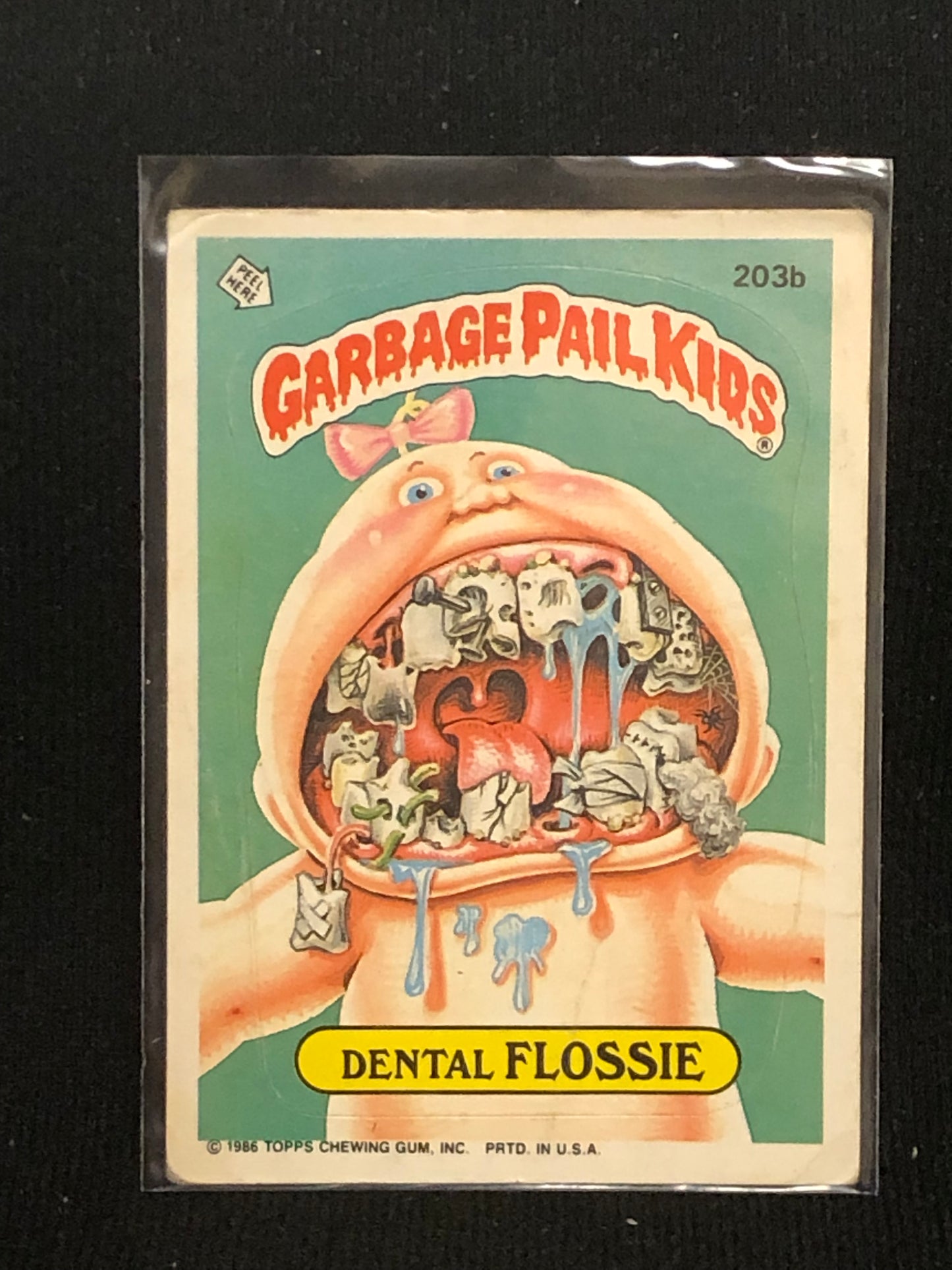 Garbage Pail Kids Original Series 5 (os5) 203b Dental Flossie